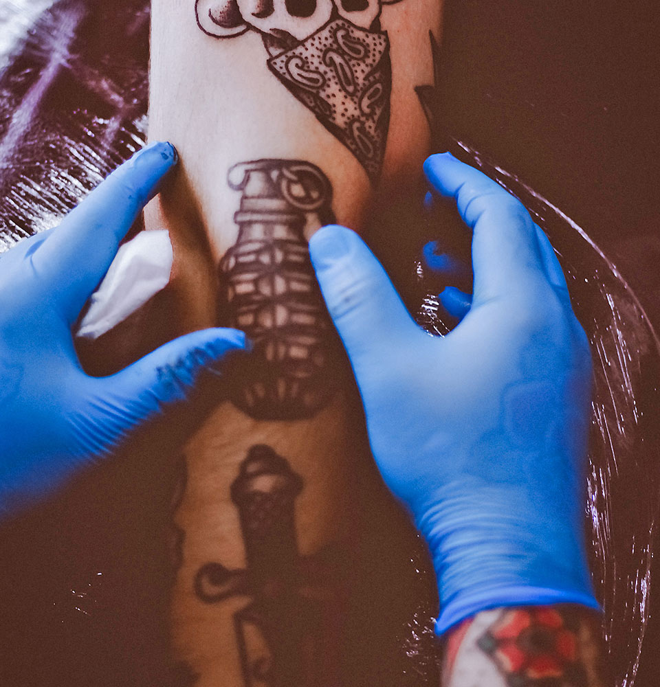 Realism Tattoos Eliminar tatuaje